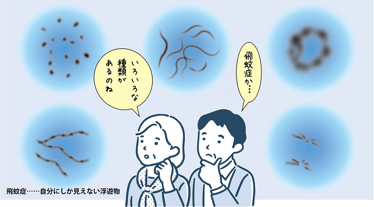 網膜剥離のサイン、飛蚊症。